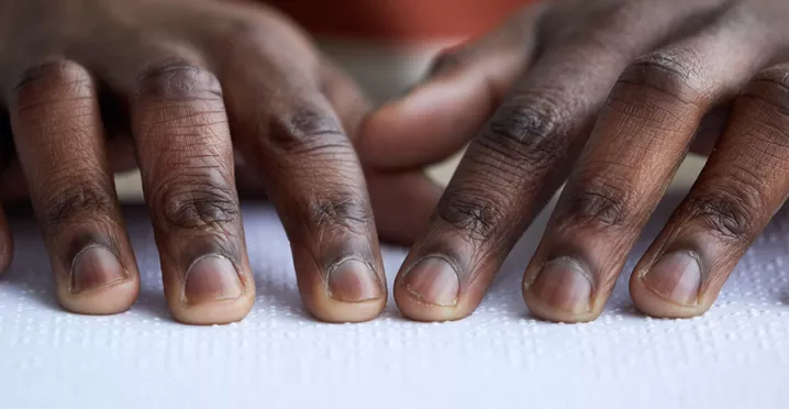 A inclusão do deficiente visual no ambiente de trabalho é importante! Veja como participar.