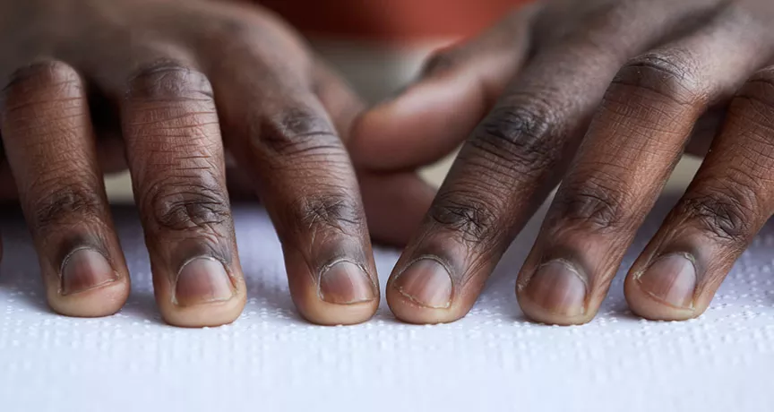 A inclusão do deficiente visual no ambiente de trabalho é importante! Veja como participar.